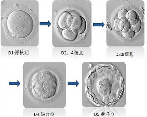广州供卵试管婴儿多少钱啊_广州试管婴儿多少钱