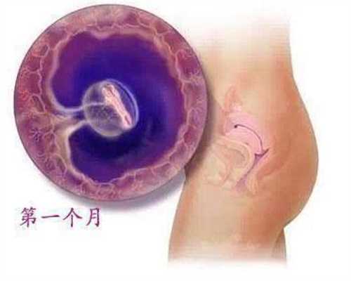 输卵管粘连需要做哪些检查