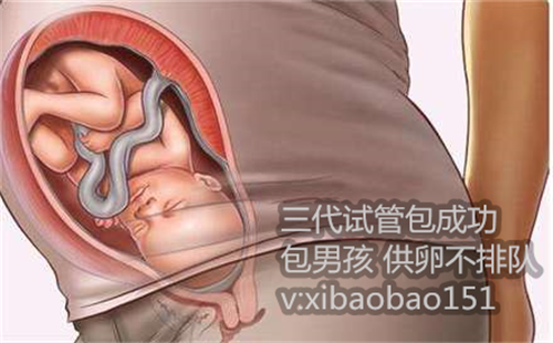 广东做试管婴儿哪家医院好？